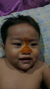 Gejala selsema biasanya disertai dengan simptom lain seperti demam, hidung tersumbat dan batuk. Hilangkan Selsema Bayi Ben Ashaari