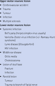 Signs and symptoms of bell's palsy. Causes Of Facial Palsy Download Table