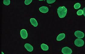 Image result for ANA Staining Pattern