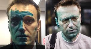 We did not find results for: Zachem Navalnyj Namazal Levuyu Chast Lica Zelenkoj Pikabu