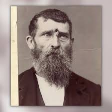 Civil War Veteran Survived Decades After Being Shot in the Forehead?