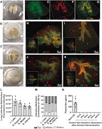Targeting lung heme iron by aerosol hemopexin adminstration in sickle cell  disease pulmonary hypertension