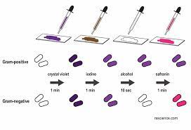 Gram Stain Steps Microbiology Microbiology Medical Laboratory Science Laboratory Science