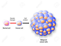 If the cells continue to grow and spread, the disease can become life threatening. Normal Human Cell Reborn To Cancer Cells And Growing To Malignant Tumor Human Anatomy Royalty Free Cliparts Vectors And Stock Illustration Image 71670057