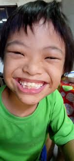 Kids with Down Syndrome.