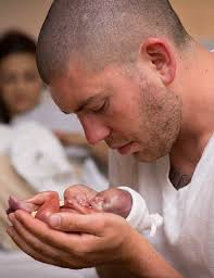Image result for Heads: Rachel Jarrot Hares Lost : Bald Head Baby.