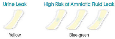 We did not find results for: Mw088 Al Sense Amniotic Fluid Leak Self Test Detector Pads Birth International