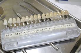 Feda Directions Teeth Whitening Chart B1