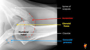 Image result for Shoulder XRay