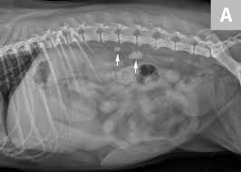 Just having kidney stones may not cause any symptoms, but when they begin to move or pass into your ureter (ureteral stones), you will likely experience symptoms. Imaging Of Calculi Of The Urinary System Clinician S Brief