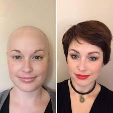 READ HER*****E: **  [https://thegioisuaazmilk.com/491/](https://thegioisuaazmilk.com/491/) 💖  Cancer-Free After 52 Chemo Sessions