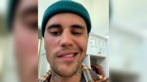 Justin Bieber revela que sufre una parálisis facial que le impide cantar