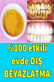sadece 2 dakikada evde dis beyazlatma dis lekesi ve sararmis disler nasil beyazlatilir dogal dis beyazlatma dis cilt urunleri