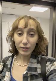 Arreglos Post Trasplante: Mi Experiencia Después de 2 Años