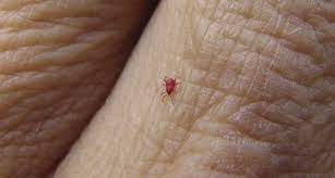 We did not find results for: Can Chiggers Live In Your Couch Find Out Now Upgraded Home