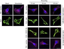 These general medical terms are oftentimes abbreviated for ease of communication. Novel Role Of Sorting Nexin 5 In Renal D1 Dopamine Receptor Trafficking And Function Implications For Hypertension Villar 2013 The Faseb Journal Wiley Online Library