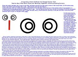 72 Cogent Presbyopia Convergence Chart Eye Exercise