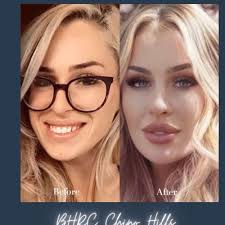 TOP 10 BEST Morpheus 8 near Corona Del Mar, Newport Beach, CA