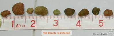 pin on liver cleanse