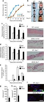 It is usually the result of poor glycemic control, underlying neuropathy, peripheral vascular disease, or poor foot care. Diabetes Impairs Wound Healing By Dnmt1 Dependent Dysregulation Of Hematopoietic Stem Cells Differentiation Towards Macrophages Nature Communications