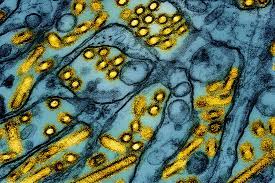 How serious is bird flu? | Hub