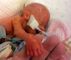 The foetus here is pictured with the head lowered towards the chest. Our Little Miracle Baby Born At Just 23 Weeks And Given Just A 1 Chance Of Survival Defies Doctors Expectations To Live Daily Mail Online