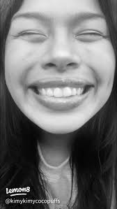 Embracing My Crooked Smile: A Journey to Confidence