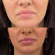 Erin Clouser RN,BSN (@erin_clouser_injects) • Instagram photos and videos