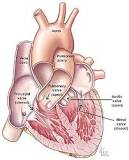 Image result for icd 10 diagnosis code for valvular heart disease
