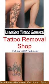 Repeat until the tattoo is removed. Best Tattoo Removal How To Remove A Tattoo Fast Scarless Tattoo Removal Custom Temporary Tattoos How Much Does Diy Tattoo Tattoo Removal Cost Tattoo Removal