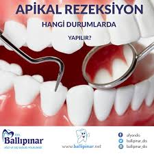 Ağız ve diş sağlığı, endodonti Dis Afyon Ballipinar Agiz Ve Dis Sagligi Poliklinigi Facebook