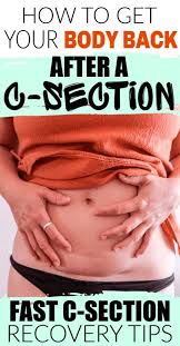 C Section Recovery Tips Italianpolishmomma Com C Section Recovery C Section C Section Workout