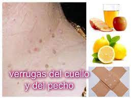 Pin En Salud