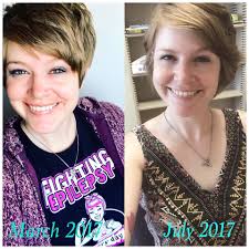 Have you successfully stopped seizure meds with keto diet?