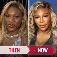 Serena Williams, gorgeous then and now! ✨