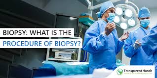 These can lead to abnormal bleeding. What Is The Procedure Of Biopsy Eua Biopsy Medical Procedure