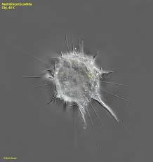 Image result for Raphidiocystis