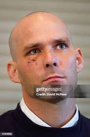 Wounded U.S. Marine Private 1st Class Gary Ragan meets with the press...  News Photo