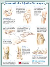 Image result for Elbow Joint Injection