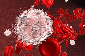 Leucemia mieloida acuta este una dintre leucemiile cu cea mai rapida dezvoltare, daca nu e tratata la timp putand duce la decesul pacientilor in decurs de exista trei grupuri de pacienti in functie de riscul datorat factorilor de mai sus. Leucemia Simptome Factori De Risc Si Tratament