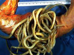 What are the signs of roundworms in humans? Equimax Horse Roundworms Parascaris Equorum