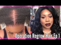 Rogaine is effective enough it can cause unwanted hair growth as well. My Journey To Regrow My Hair Using Rogaine For Women Ep 1 Youtube