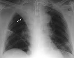 Bildgebende Verfahren Rontgen Ultraschall Ct Nuklearmedizin Springerlink