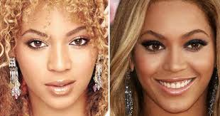 Beyonce Plastic Surgery Before After Celebrity Plastic Surgery Beyonce Plastic Surgery Beyonce Nose Job Celebrity Plastic Surgery