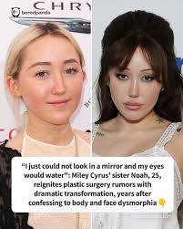 I just could not look in a mirror and my eyes would water”: Miley Cyrus'  sister Noah, 25, reignites plastic surgery rumors with dramatic  transformation, years after confessing to body and face