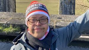 Down syndrome is associated with a host of distinctive physical characteristics, medical issues, and developmental and intellectual delays. World Down Syndrome Day Welsh Cake Baker S Pride In Business Bbc News