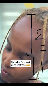 Celebrating Somali Heritage: Strong Forehead Gene