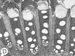 Image result for Albertisia exelliana