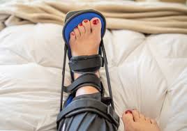 Image result for Posterior Night Splint