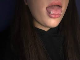 Zungenpiercing Entzundet Achtung Bild Piercing